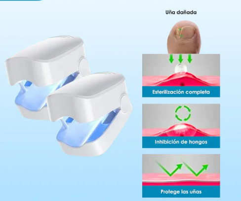 Tratamiento Láser para Hongos en las Uñas