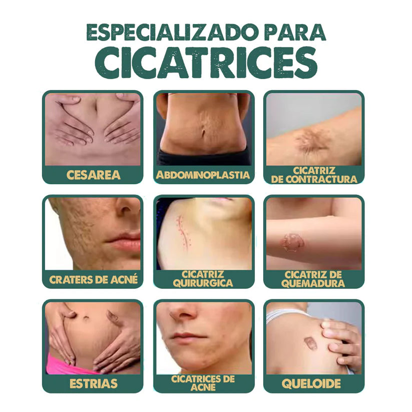 Spray Elimina Cicatrices | South Moon