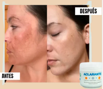 Crema aclarante