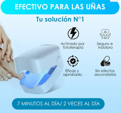 Tratamiento Láser para Hongos en las Uñas