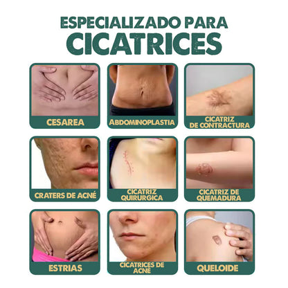 Spray Elimina Cicatrices | South Moon